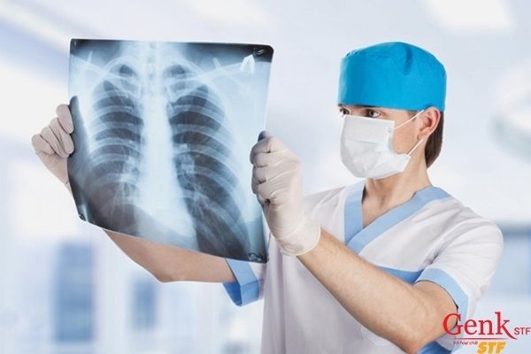 Các phương pháp điều trị ung thư phổi