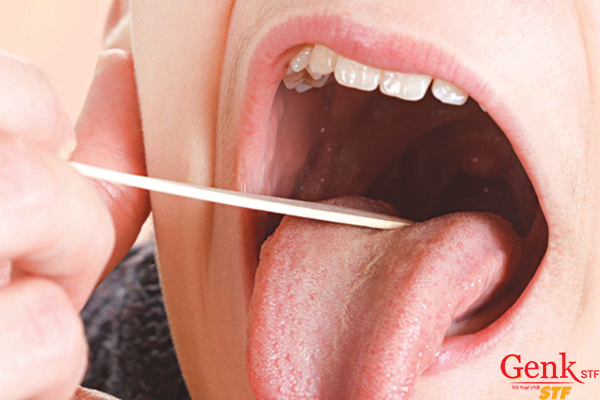 Ăn uống lành mạnh để phòng ngừa ung thư vòm họng