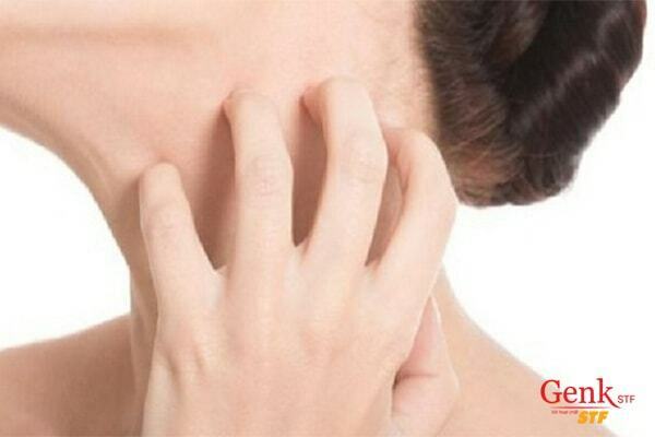 Ngứa da là biểu hiện ung thư gan sớm