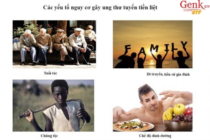 Nguyên nhân gây ung thư tuyến tiền liệt