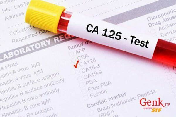 CA125 là một chỉ số giúp đánh giá ung thư buồng trứng