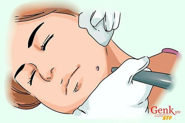 Đốt bỏ thương tổn là một trong số các phương pháp điều trị ung thư da