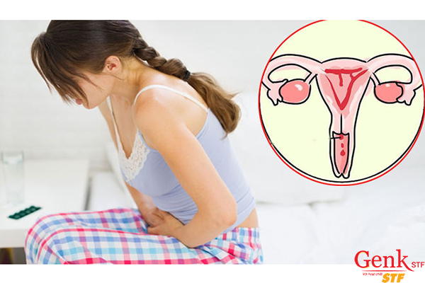 Ai là người có nhiều nguy cơ mắc ung thư cổ tử cung?