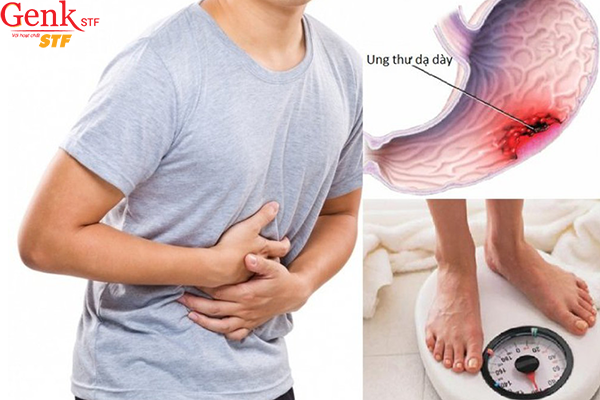 Sụt (tụt) cân là dấu hiệu của bệnh ung thư dạ dày không thể bỏ qua