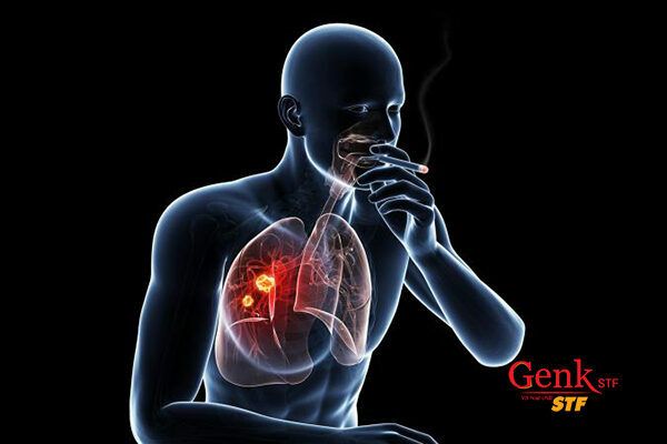 Thuốc lá là nguyên nhân gây ra 22% các trường hợp ung thư