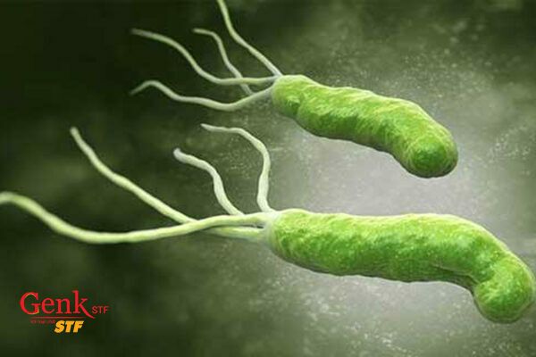 Nhiễm khuẩn Helicobacter pylori được cho là nguyên nhân của đa số các loại ung thư dạ dày
