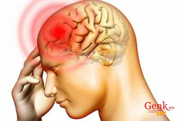 Ung thư não là loại ung thư cực kì nguy hiểm, dễ gây tử vong