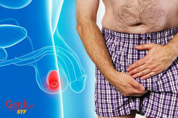 Hầu hết các loại ung thư tinh hoàn phát triển trong các tế bào sản xuất tinh trùng