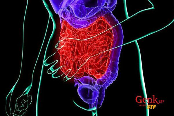 Điều trị ung thư bàng quang không triệt để, bệnh rất dễ tái phát