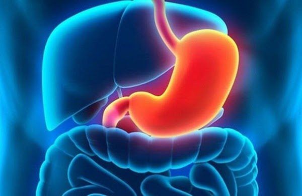 Viêm loét dạ dày có thể do nhiều nguyên nhân gây ra