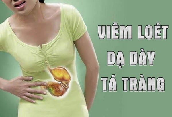 Viêm loét dạ dày tá tràng là tình trạng tổn thương một hay nhiều vùng niêm mạc dạ dày tá tràng