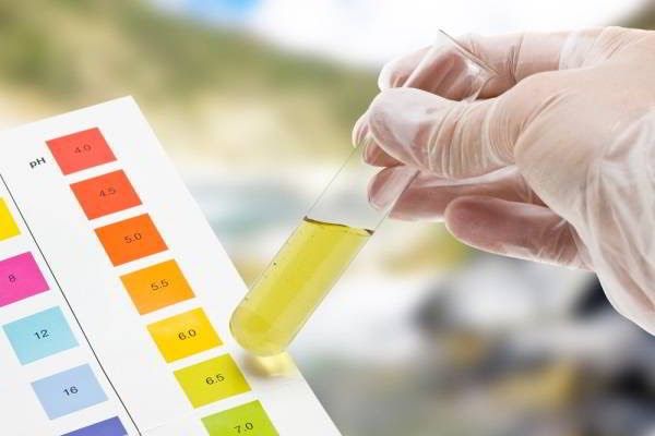 Xét nghiệm nước tiểu là một trong những xét nghiệm chẩn đoán ung thư bàng quang