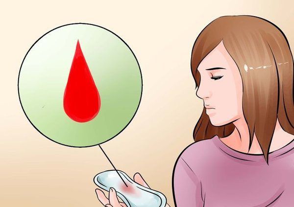 Âm đạo chảy máu không rõ nguyên nhân là một trong những dấu hiệu ung thư cổ tử cung điển hình