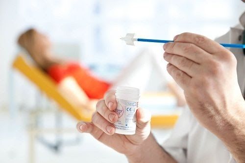 Tầm soát ung thư cổ tử cung có thế phát hiện ra bệnh từ giai đoạn rất sớm