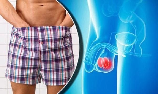 Triệu chứng ung thư tinh hoàn, nam giới có thể sờ thấy khối u, cảm giác nặng ở trong bìu