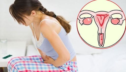 Những người có tiền sử gia đình có người thân mắc ung thư cổ tử cung cũng làm tăng nguy cơ mắc bệnh