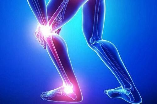Ung thư xương là bệnh lý ác tính bắt nguồn ở xương