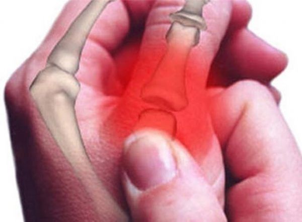 Đau nhức xương là triệu chứng phổ biến của ung thư xương