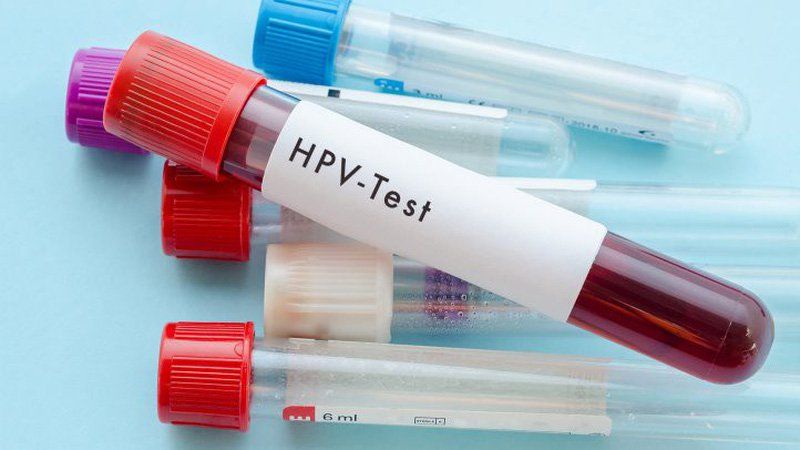 Xét nghiệm HPV được sử dụng cho phụ nữ trên 30 tuổi, thường thực hiện kết hợp cùng xét nghiệm Pap