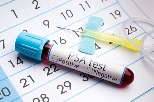Xét nghiệm PSA là phương pháp giúp phát hiện ung thư tiền liệt tuyến ngay từ những giai đoạn đầu