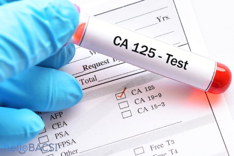 Xét nghiệm CA 125 giúp phát hiện ung thư máu
