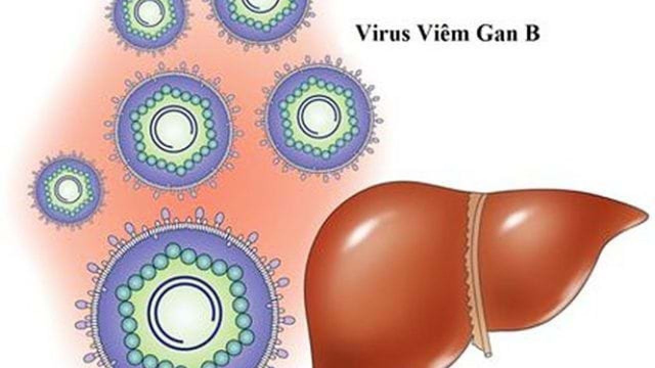 Mắc virus viêm gan B có nguy cơ cao mắc ung thư gan