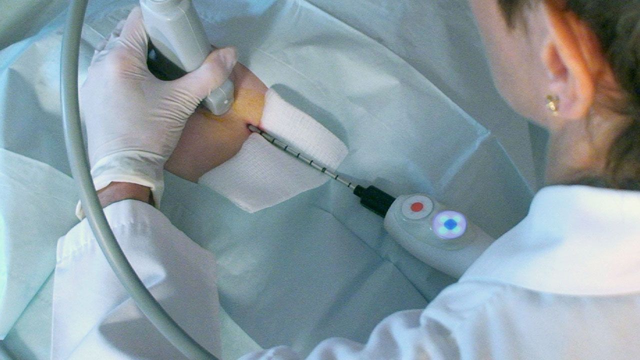Điều trị ung thư vú gồm 2 phương pháp điều trị chính là điều trị toàn thân và điều trị tại chỗ.