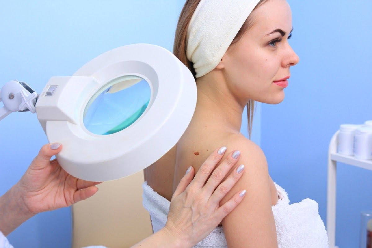 Sinh thiết giúp chẩn đoán ung thư da chính xác hơn