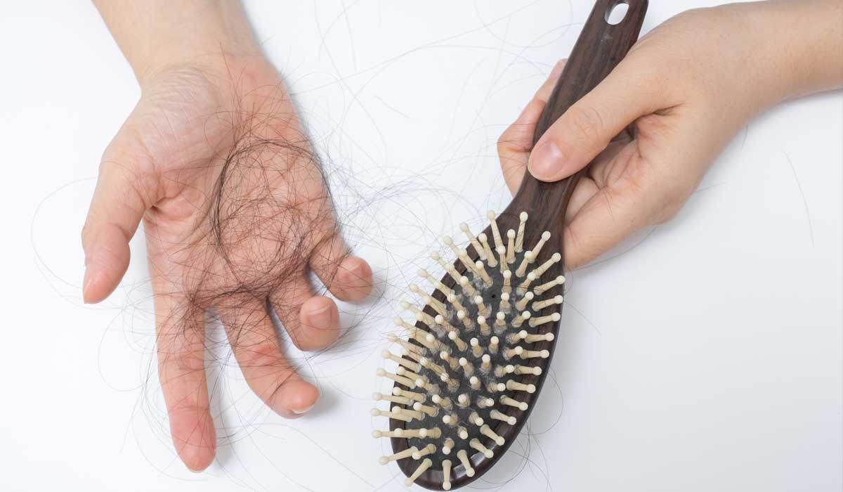 Hầu hết người bệnh bị rụng tóc khi hóa trị