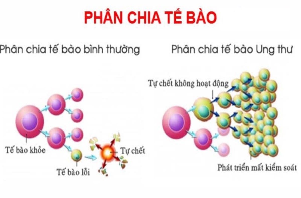 Tế bào ung thư tăng sinh mất kiểm soát