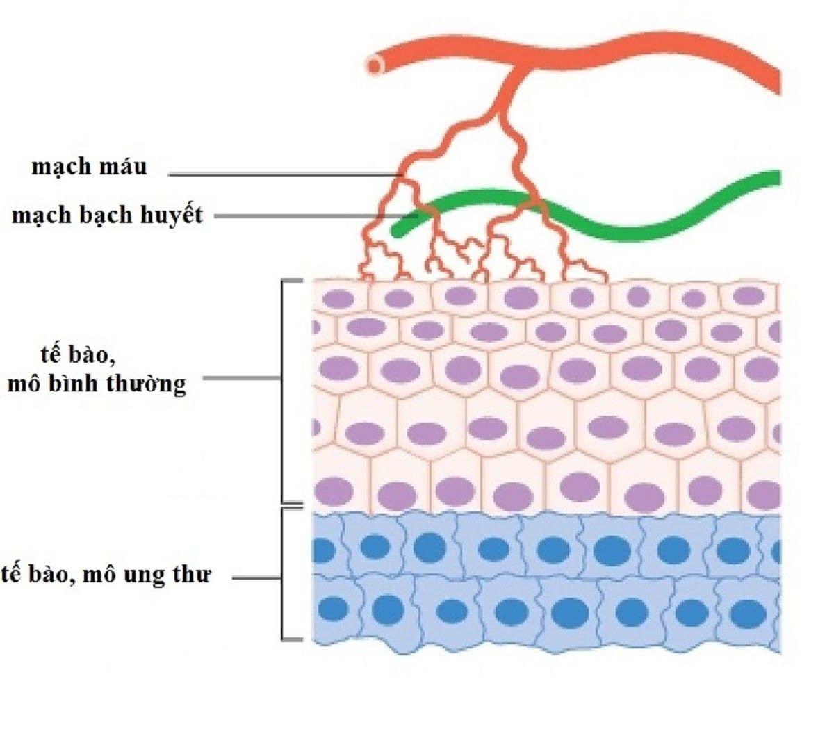 Sự kích thích tăng sinh mạch máu cho tế bào ung thư