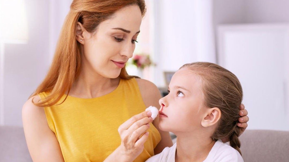 Chảy máu cam là một triệu chứng ung thư máu khá phổ biến