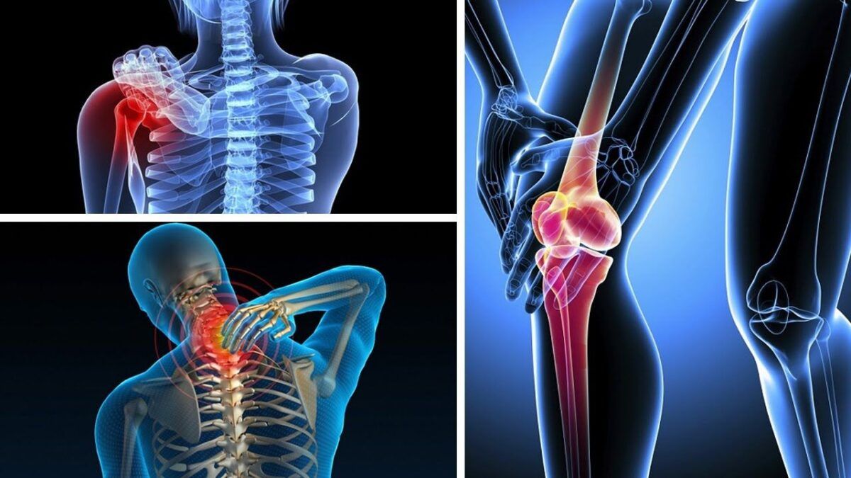 Ung thư xương là bệnh ung thư hiếm gặp nhưng rất nguy hiểm đến tính mạng người bệnh
