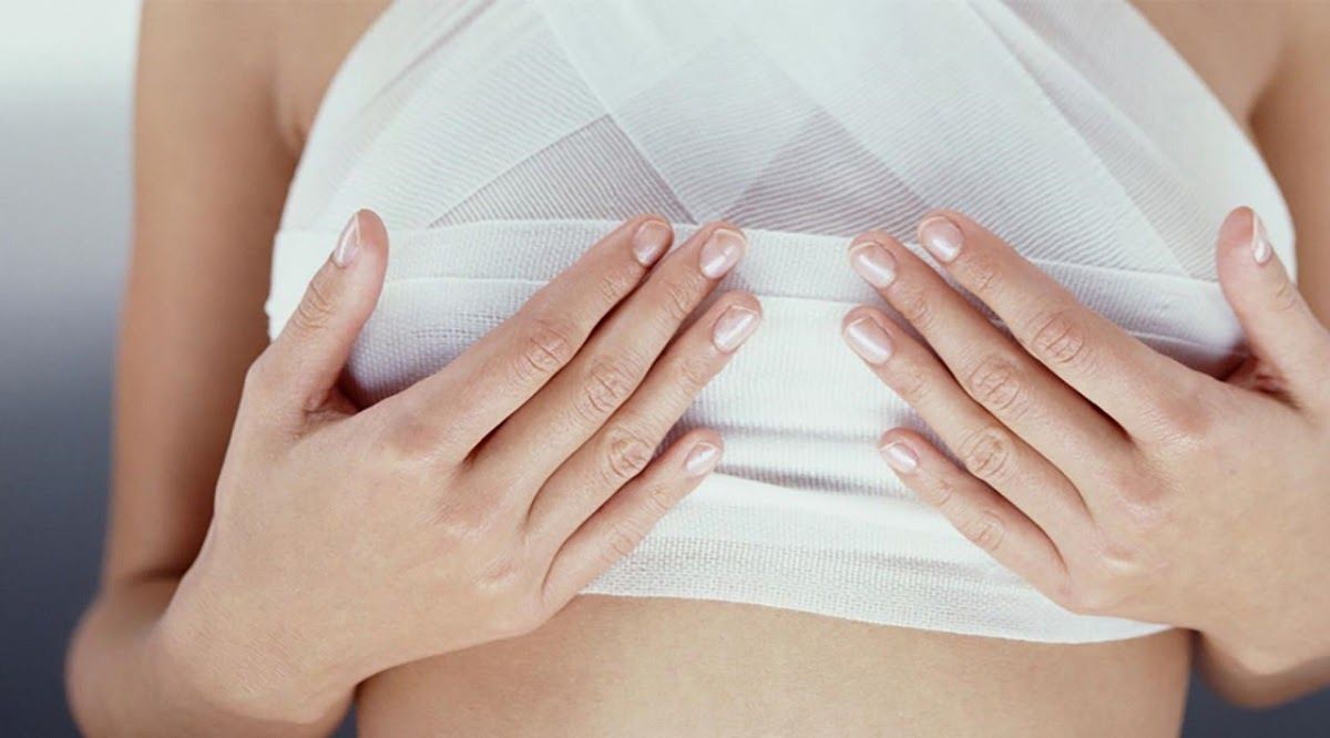 Phụ nữ có nguy cơ cao mắc ung thư vú có thể lựa chọn cắt bỏ vú.