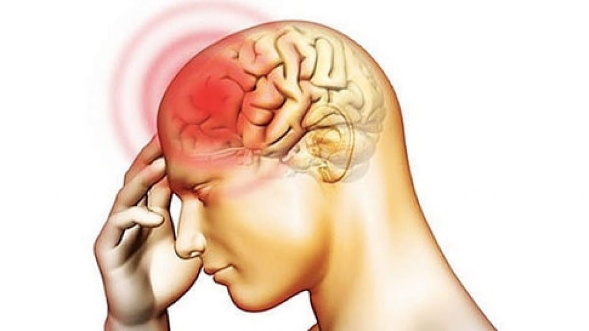Nhức đầu, hoa mắt là một trong những triệu chứng ung thư não phổ biến