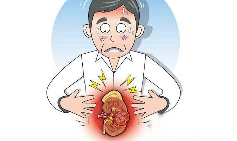 Phát hiện các triệu chứng ung thư thận sớm giúp bạn được điều trị tốt hơn