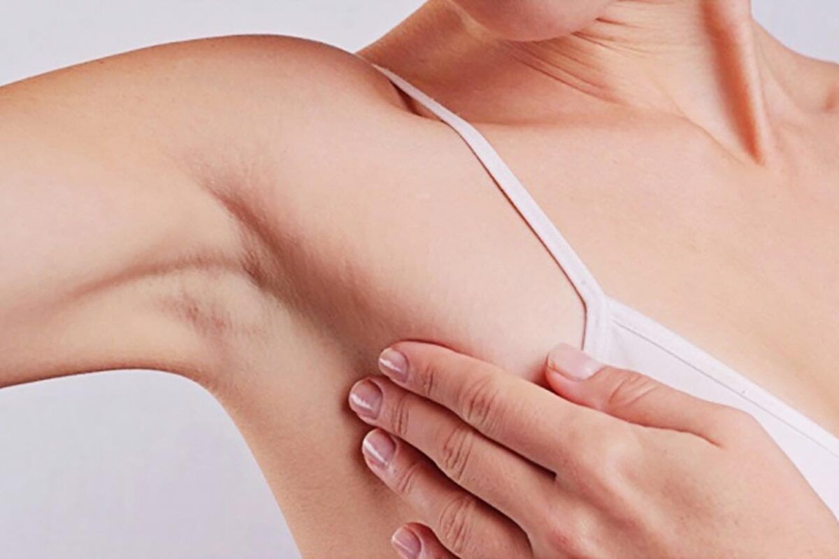 Xuất hiện khối u ở vú là triệu chứng bệnh ung thư vú