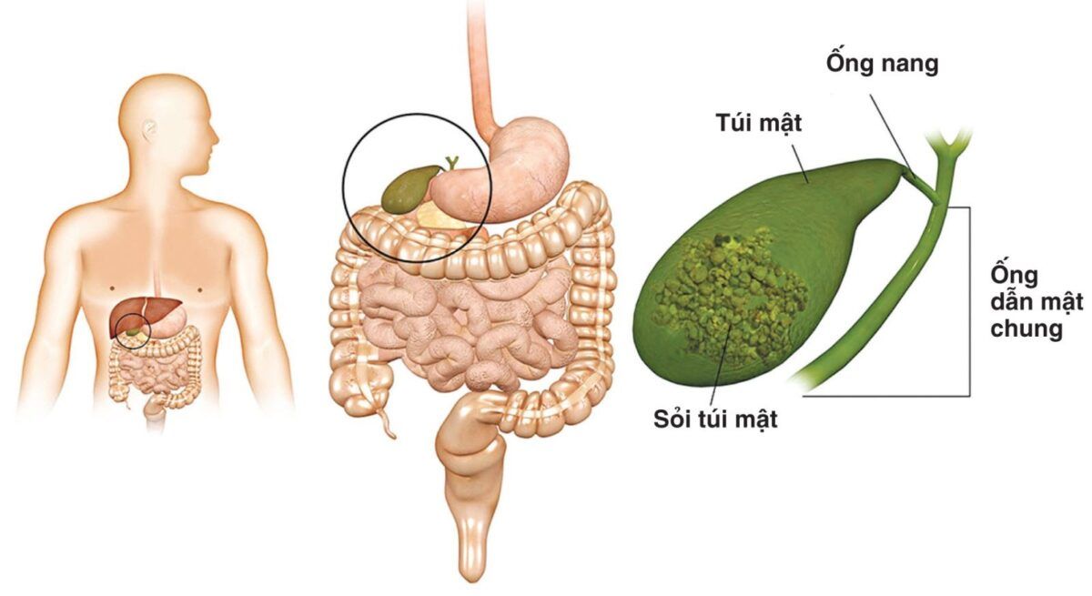 Ung thư đường mật khi đến giai đoạn cuối thì các cơn đau sẽ càng rõ rệt và khó chịu hơn 