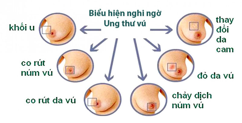 Không nên bỏ qua bất kỳ dấu hiệu nhận biết ung thư nào