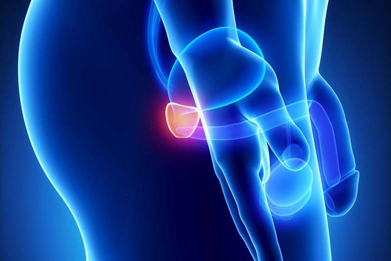 Bệnh được chia ra làm 4 giai đoạn cụ thể