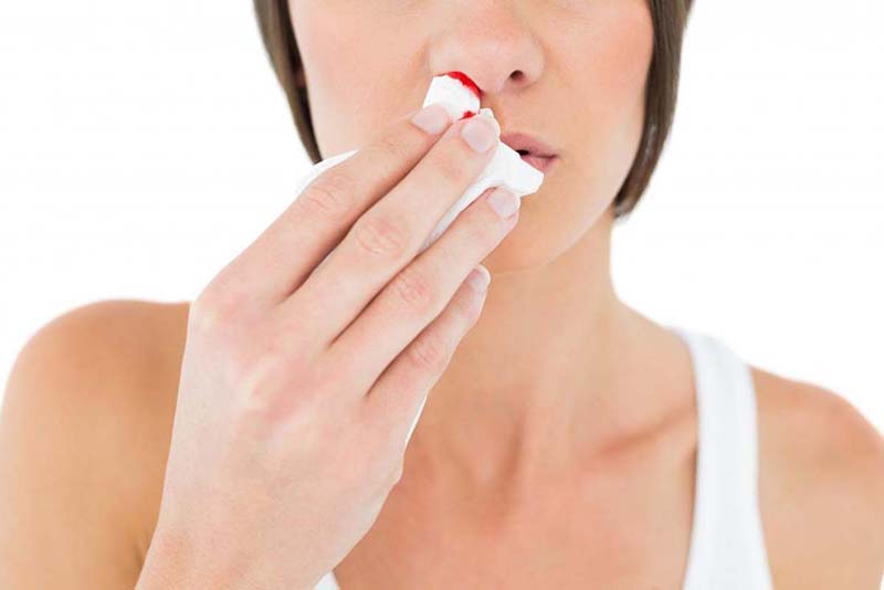 Chảy máu mũi có thể là một triệu chứng của bệnh ung thư vòm hầu