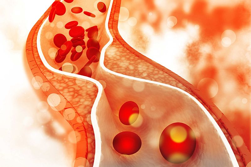 Thông thường, để xác định tình trạng mỡ máu, người ta dựa vào nồng độ cholesterol