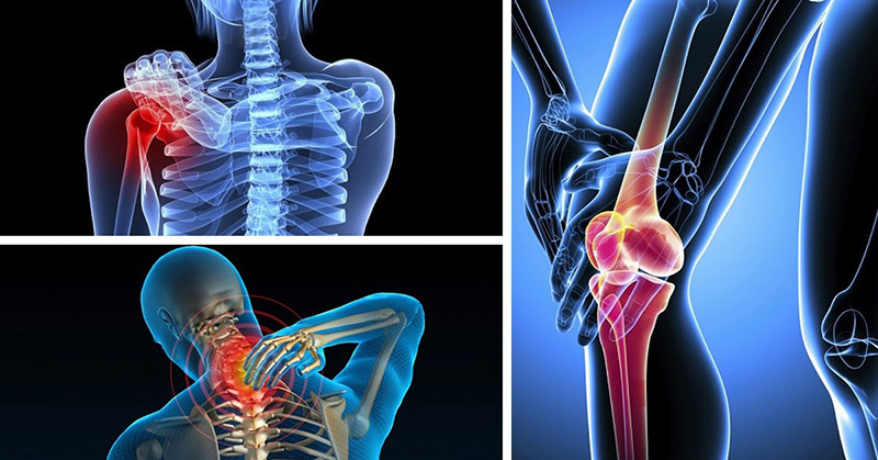 Ung thư xương là căn bệnh hiếm gặp so với các loại bệnh ung thư khác hiện nay