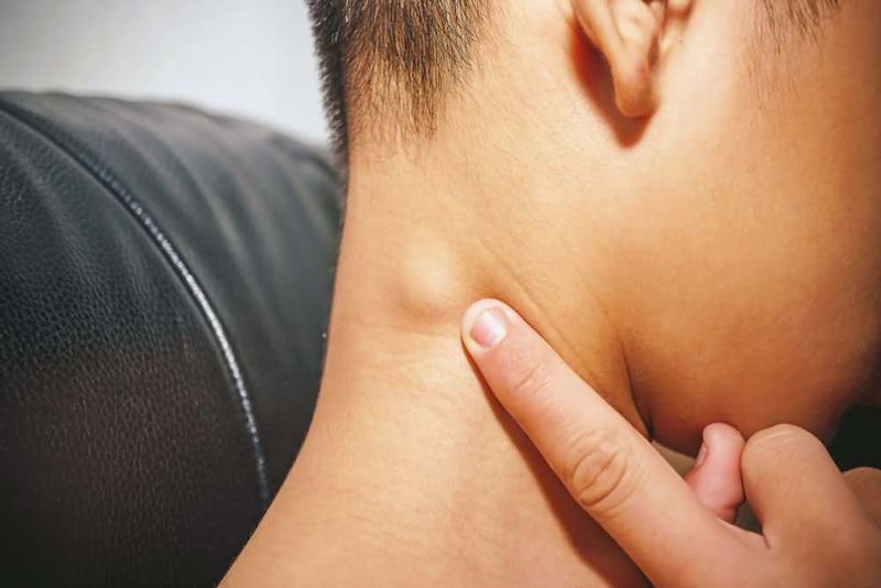 Dấu hiệu ung thư máu - bệnh ung thư hạch
