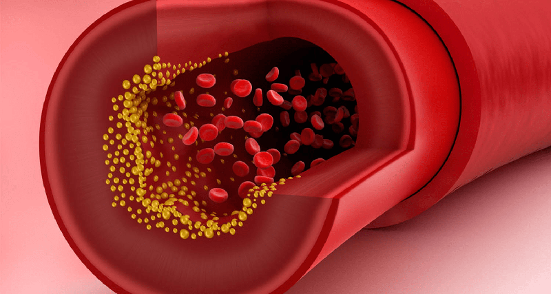 Fucoidan giúp giảm hàm lượng cholesterol trong máu, phòng ngừa bệnh mỡ máu cao