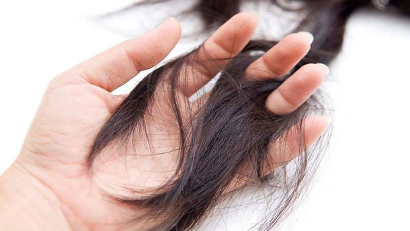 Rụng tóc là biểu hiện đầu tiên khi xạ trị ung thư