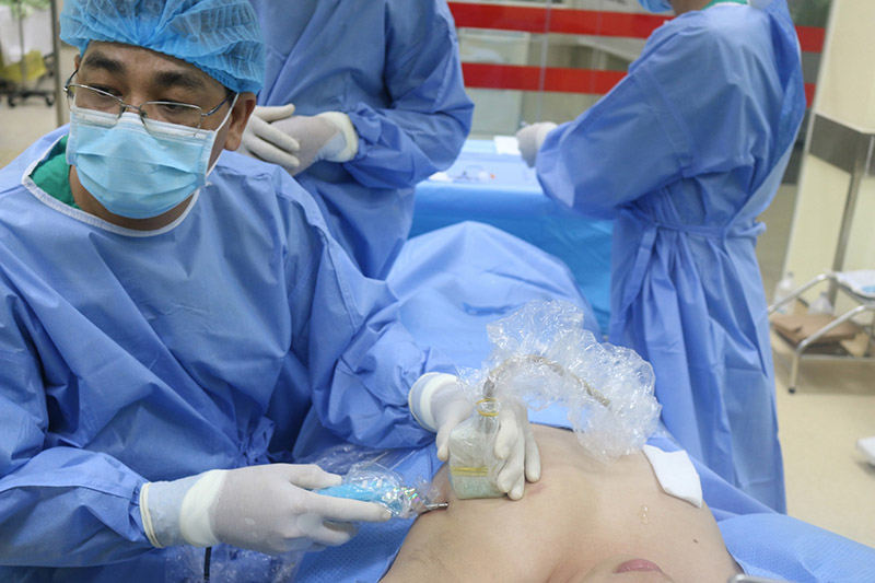 Sinh thiết phổi là phương pháp lấy mẫu phổi, sau đó nhuộm màu và soi dưới kính hiển vi