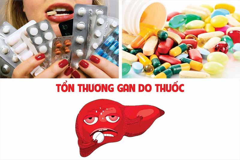 Thuốc hạ mỡ máu dùng bao lâu? Dừng sử dụng khi xuất hiện những tác dụng phụ của thuốc