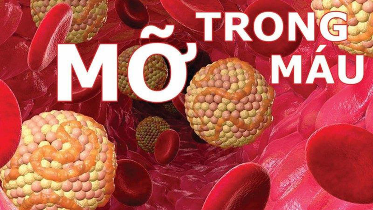 giam-mo-mau-tot-nhat_12