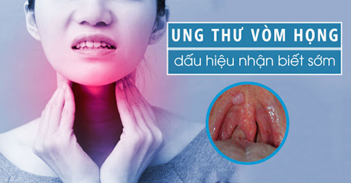 ung-thu-vom-hong_13